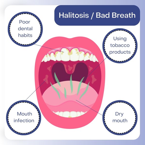 A visual illustrating the various oral and systemic factors influencing bad breath.