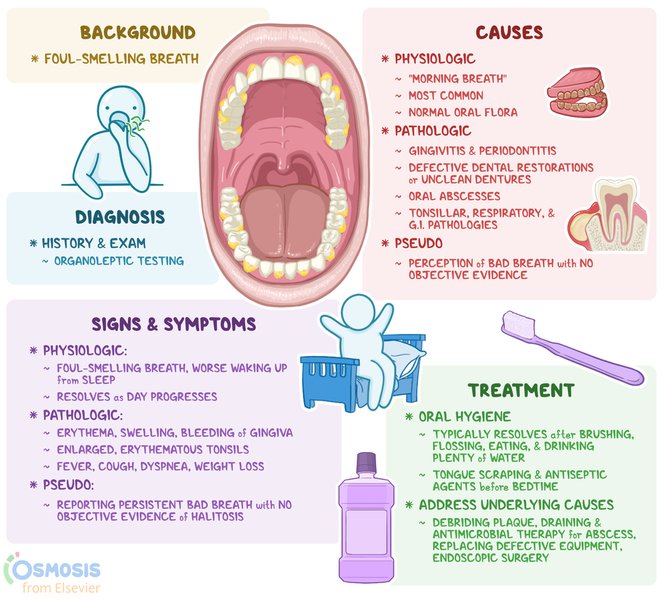 An illustrative depiction of halitosis and its potential underlying causes.